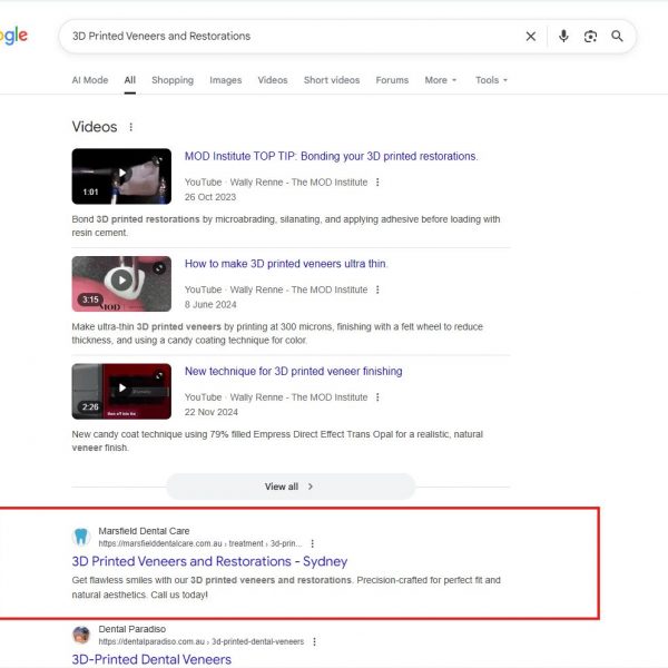Google result showing Marsfield Dental Care for 3D printed veneers and restorations