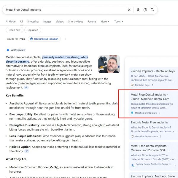 Google AI overview showing Marsfield Dental Care for metal free dental implants